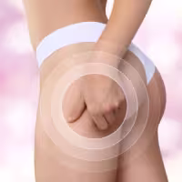 Gros plan sur la fesse d'une femme en culotte blanche, la main pinçant la peau, avec des cercles graphiques illustrant l'action du soin